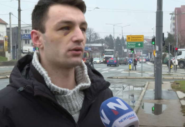 (VIDEO) Mladić pretučen u stanu jer je pripadnik LGBT za Newsmax Balkans: Nasilje nije odgovor niti rešenje