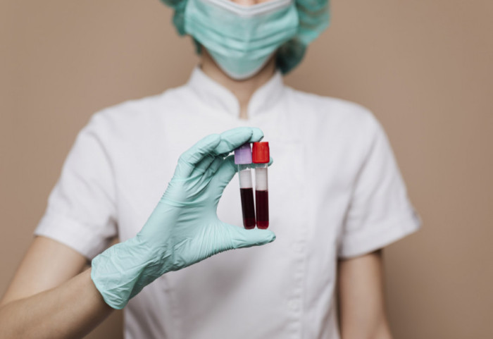 Jednostavan test krvi mogao bi da pomogne u prevenciji hiljade srčanih udara, pokazala naučna studija