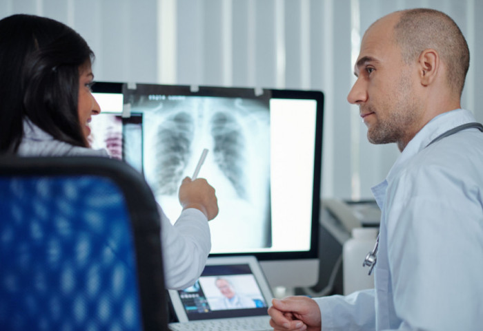 Veštačka inteligencija može da otkrije rak pluća mesecima unapred i to iz osnovnih medicinskih analiza
