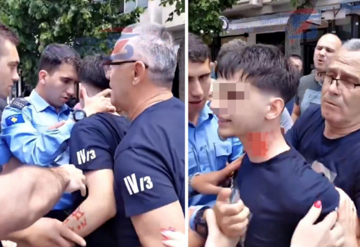 (VIDEO) Incident u Severnoj Mitrovici: Pripadnik kosovske policije napao srpskog maturanta