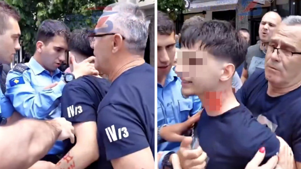 (VIDEO) Incident u Severnoj Mitrovici: Pripadnik kosovske policije napao srpskog maturanta